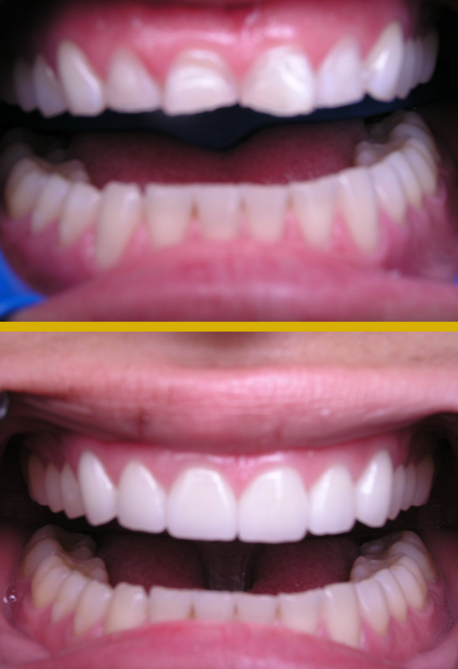 Before and after