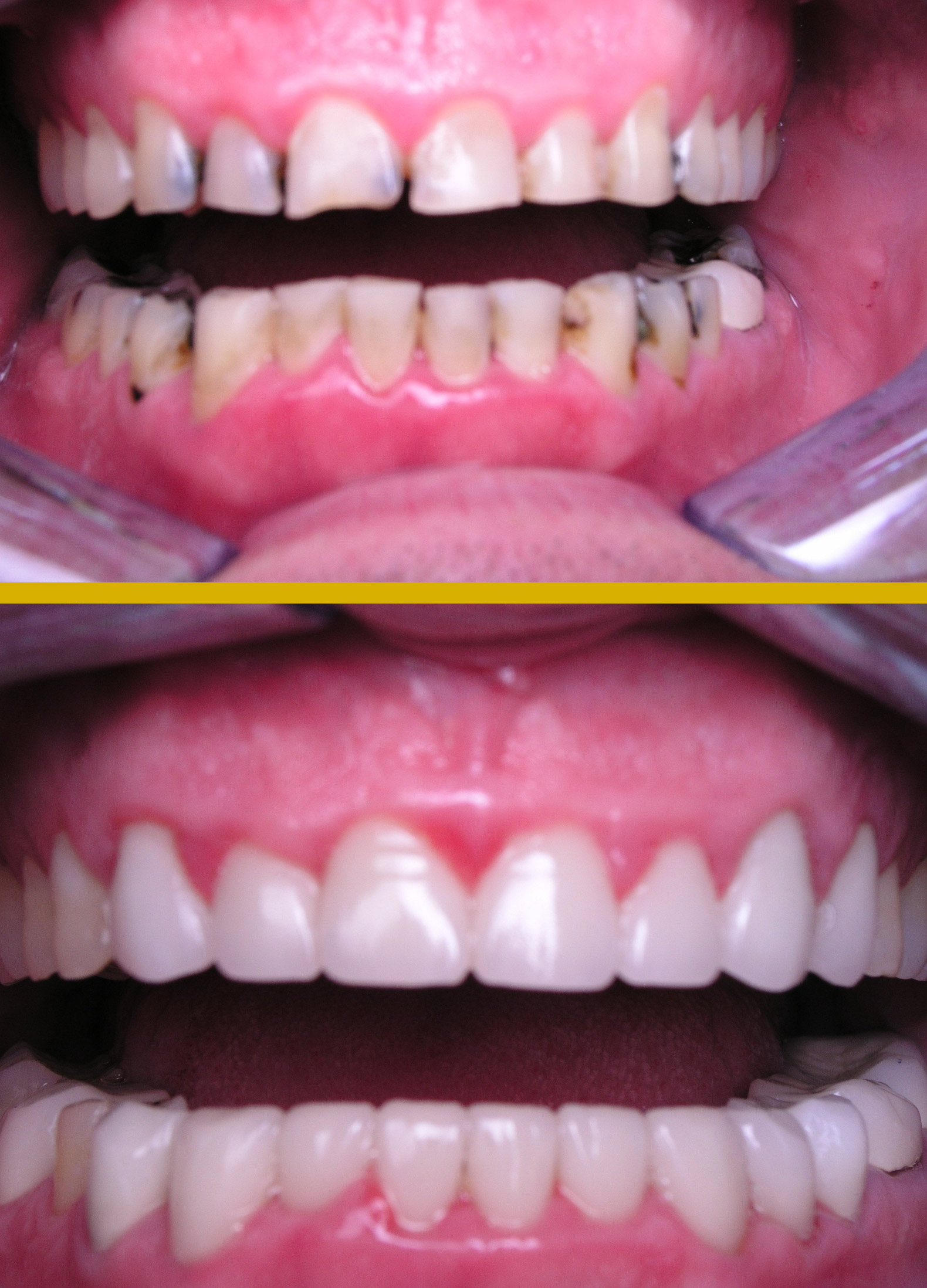 Before and after