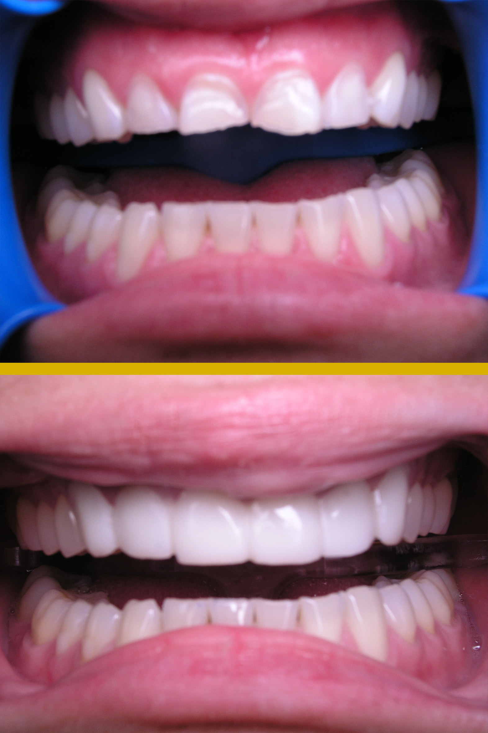 Before and after